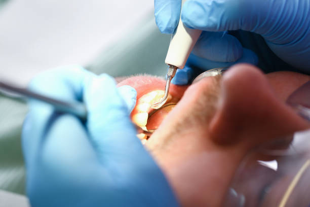 Best Emergency Denture Repair in Kirkwood, MO